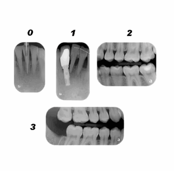 Placas de imagen dental de fosforo (con imán). Ver medidas - Imagen 2